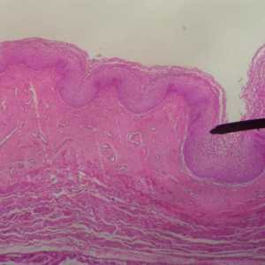 Duljina cerviksa tjednima tijekom trudnoće