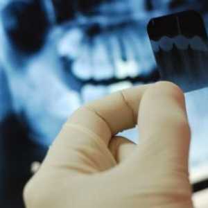 Dokumenti za odbitak od poreza za stomatološko liječenje. Odbitak od poreza za implantaciju zuba