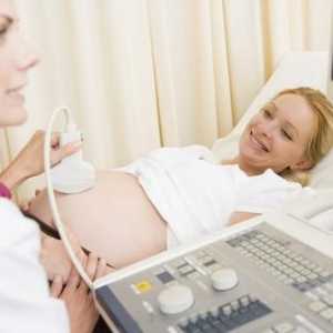 Doppler pregled u trudnoći