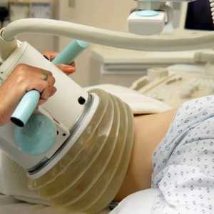 Razbijanje bubrežnih kamenica ultrazvukom: recenzije, cijene