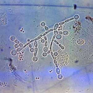 Gljivice slične kvasca roda Candida