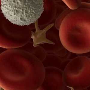 Ako je limfocit povišen u krvi - što to znači?