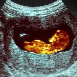 Fetometrija fetusa tjednima. Veličina fetusa tjednima