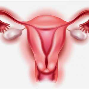 Fibroids jajnika: simptomi, uzroci, liječenje