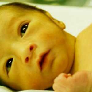 Fiziološka žutica novorođenčeta: uzroci, simptomi i metode liječenja