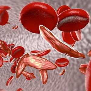 Frakcije krvnih proteina elektroforezom