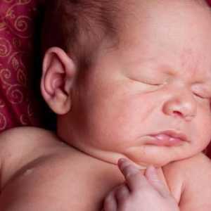 Gljiva pupak u novorođenčadi: uzroci, liječenje, fotografija