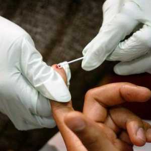 Gdje i kako uzimati anonimno HIV testove