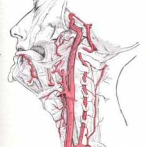 Hipoplazije lijeve vertebralne arterije. Uzroci. Simptomi. liječenje