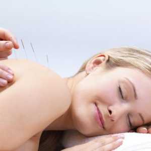 Akupunktura: indikacije i kontraindikacije, recenzije