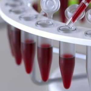 Imunoenzimska analiza krvi: tumačenje rezultata