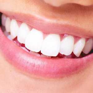 Implantat ili kruna - što je bolje za zub?