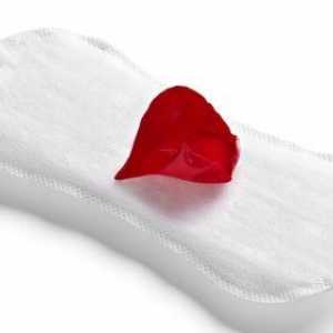 Krvarenje implantacije ili menstruacija: kako se razlikovati?