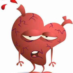Ishemijska srčana bolest. Što je to i koje su njegove manifestacije?