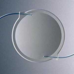 Umjetna intraokularna leća: vrsta, proizvođači, recenzije