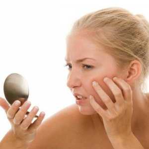 Učinkovita mast iz nadraženosti kože