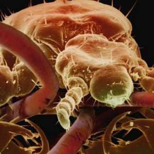 Ektoparaziti - to je ono što? Kako se riješiti parazita na površini ljudskog tijela i životinja?