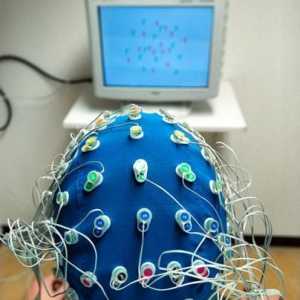 Elektroencefalografija - što je to? Kako se izvodi elektroencefalografija?