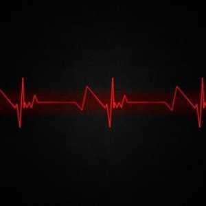Kako čitati EKG? Kako mogu sami dekodirati elektrokardiogram? Što EKG pokazuje