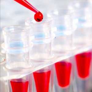 Kako se pripremiti za isporuku biokemijskog testa krvi? Kako je priprema za isporuku krvi za…
