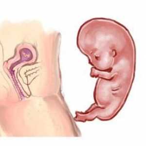 Kako se riješiti trudnoće u ranoj fazi: tradicionalne i netradicionalne metode