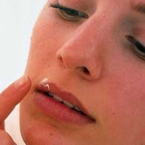 Kako se riješiti prehlade na usnama: popis najučinkovitijih metoda