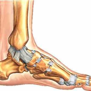 Kako liječiti stezanje ligamenta na nozi. Sprječavanje istezanja: liječenje i daljnji oporavak