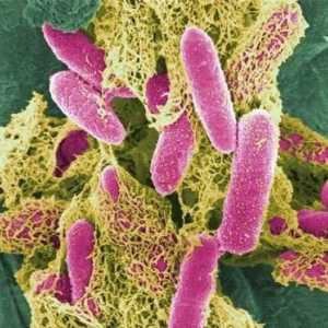 Kako se prenosi staphylococcus aureus? Rizična skupina, prevencija