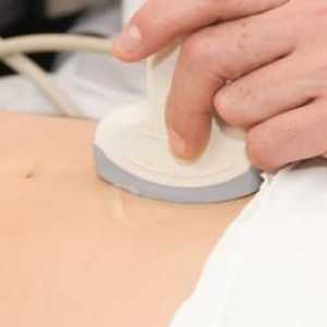 Kako se pripremiti za ultrazvuk trbuha? Što će ultrazvuk trbuha pokazati?