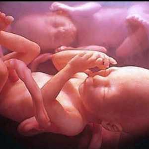 Kako su rođeni blizanci? Trbuh nakon poroda blizanaca