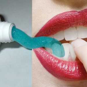 Kako se izbjeljuje zube: metode. Izbjeljivanje zubi: najučinkovitije i sigurnije metode. Preporuke…