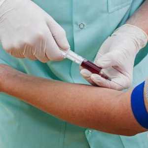 Kako proći krvni test za sterilnost?