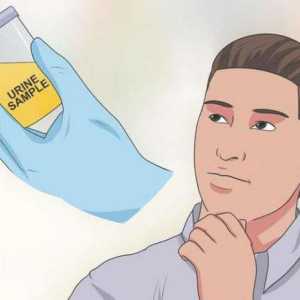 Kako mogu proći urin test na droge droga?