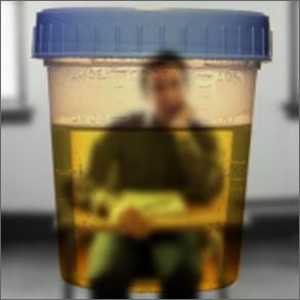 Kako pravilno poslati test urina?