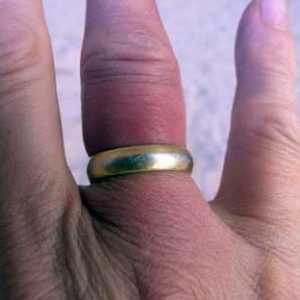 Kako ukloniti prsten s natečenog prsta?