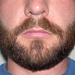 Kako ubrzati rast brade? Savjeti i trikovi