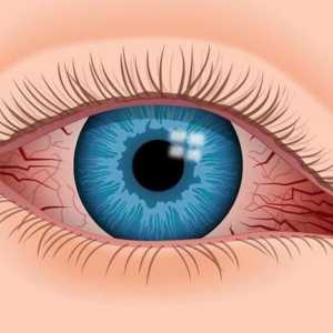Kapi za oči vazokonstriktivne: primjena i nazivi priprema