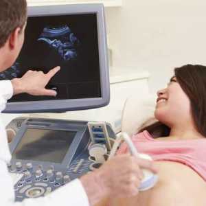 Kada napraviti treći ultrazvuk u trudnoći? U koje je vrijeme planirano 3 ultrazvuka u trudnoći?