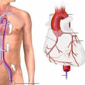 Koronarna angiografija posuda srca: kako oni rade, troškove, komplikacije. Koronarna angiografija…