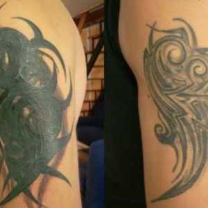 Ispravljanje tetovaža nakon iscjeljivanja: opis postupka. Tattoo salon