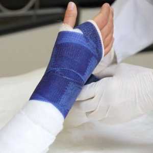 Ispravno nametnuta traka na ruci osigurava ispravno spajanje frakture