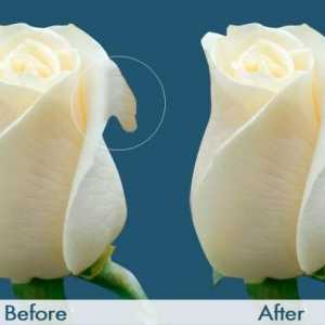 Labioplastika: prije i poslije. Recenzije, cijene