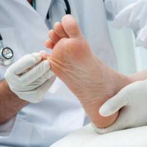Lakiranje od noktiju na noge: recenzije, primjena, režima liječenja