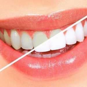 Laminiranje zuba: opis postupka, recenzije