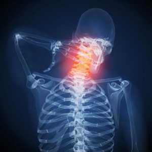 Fizioterapijske vježbe za osteokondroze cervikalne kralježnice: fotografije, vježbe