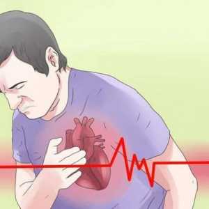 Liječenje IHD-a: lijekovi. Ishemijska srčana bolest - liječenje, lijekovi i simptomi
