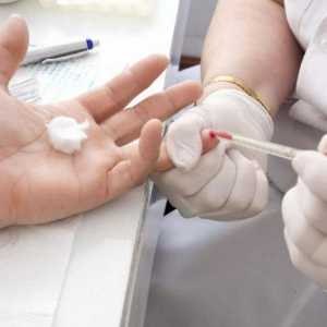 Medicinska pitanja: što trebate znati o testiranju i zašto uzeti krv iz prstena?