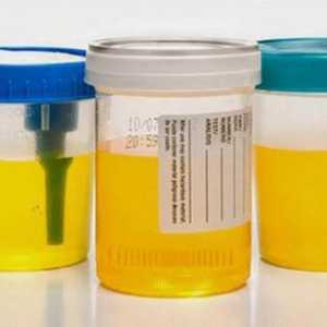 Mijenja li se boja urina tijekom trudnoće?