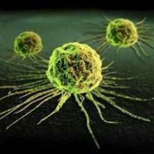 Metode otkrivanja stanica raka u ljudskom tijelu