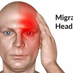Migrena: kako ublažiti bol. Kako ublažiti glavobolju migrene